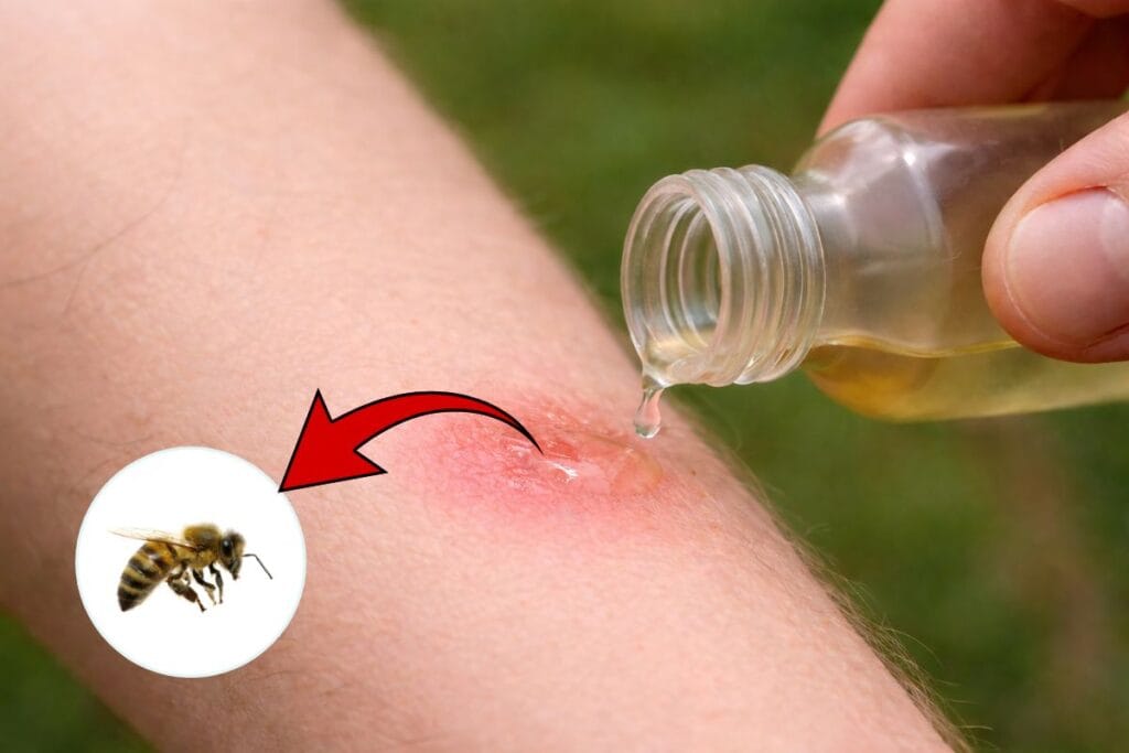 applying vinegar on a bee sting is a good remedy or not