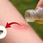 applying vinegar on a bee sting is a good remedy or not