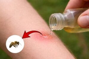 applying vinegar on a bee sting is a good remedy or not